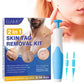 GoodsU™ 2-in-1 Skin Tag Remover Kit