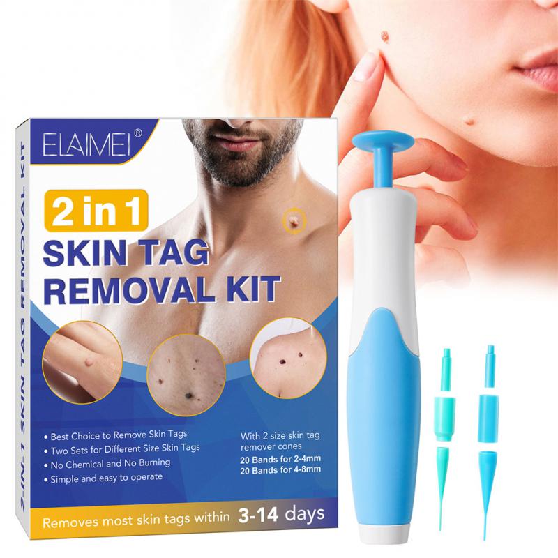 GoodsU™ 2-in-1 Skin Tag Remover Kit